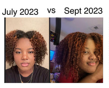 Load image into Gallery viewer, Hair Growth Starter Kit: Essential Products for Longer, Thicker, Healthier Hair