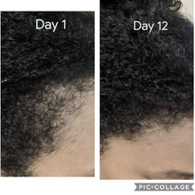 Load image into Gallery viewer, Before and after Miracle Rice Oil treatment, showcasing hair regrowth and healthier strands