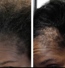 Load image into Gallery viewer, Before and after hair growth results using Miracle Rice Oil, showing thicker hair growth"