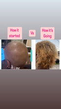 Load image into Gallery viewer, Hair Growth Starter Kit: Essential Products for Longer, Thicker, Healthier Hair
