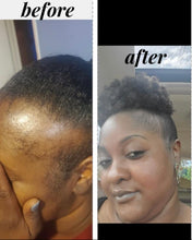 Load image into Gallery viewer, Hair Growth Starter Kit: Essential Products for Longer, Thicker, Healthier Hair
